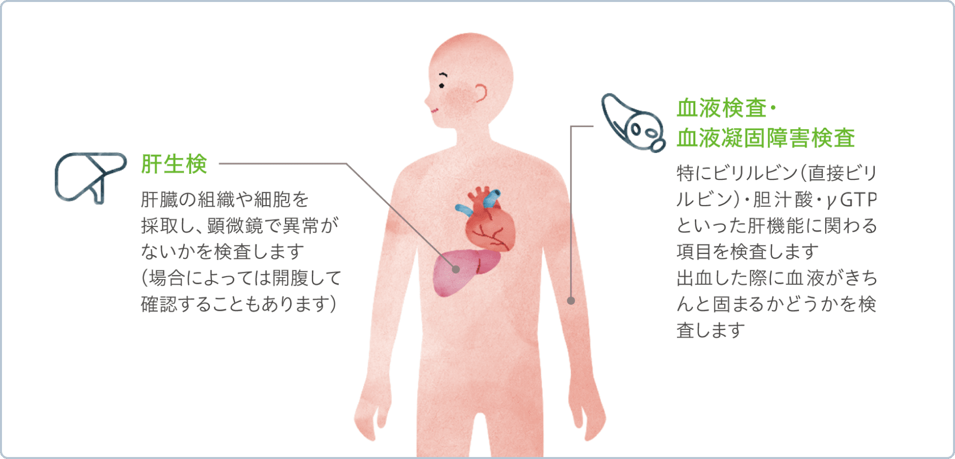 肝生検 肝臓の組織や細胞を採取し、顕微鏡で異常がないかを検査します(場合によっては開腹して確認することもあります), 血液検査・血液凝固障害検査 特にビリルビン(直接ビリルビン)・胆汁酸・γGTPといった肝機能に関わる項目を検査します 出血した際に血液がきちんと固まるかどうかを検査します